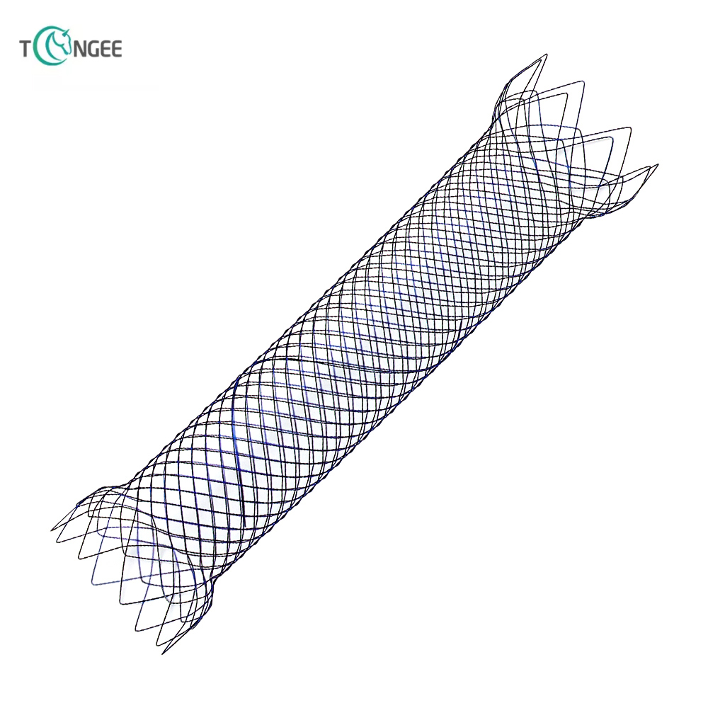 Intestinal Stent - Colon Stent