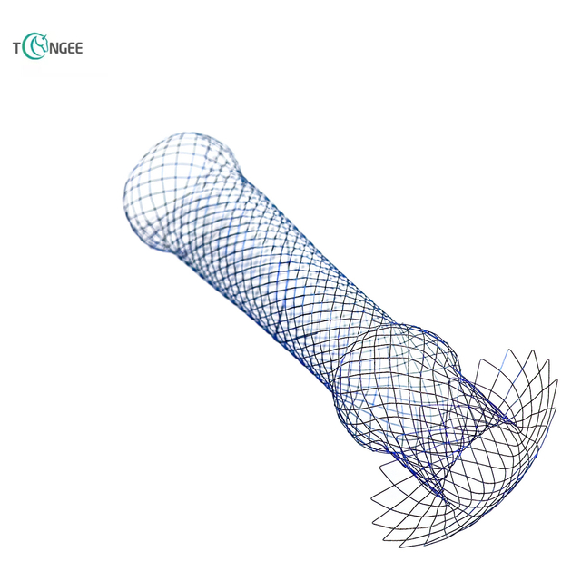 Customized Stent - Based on Customer Design