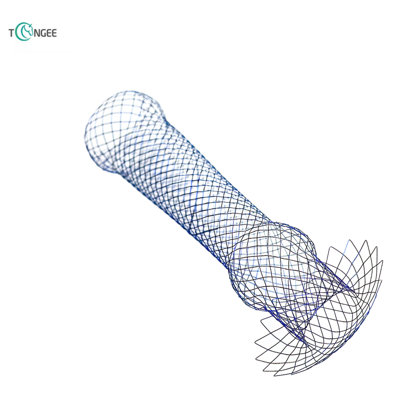 Customized Stent - Based on Customer Design