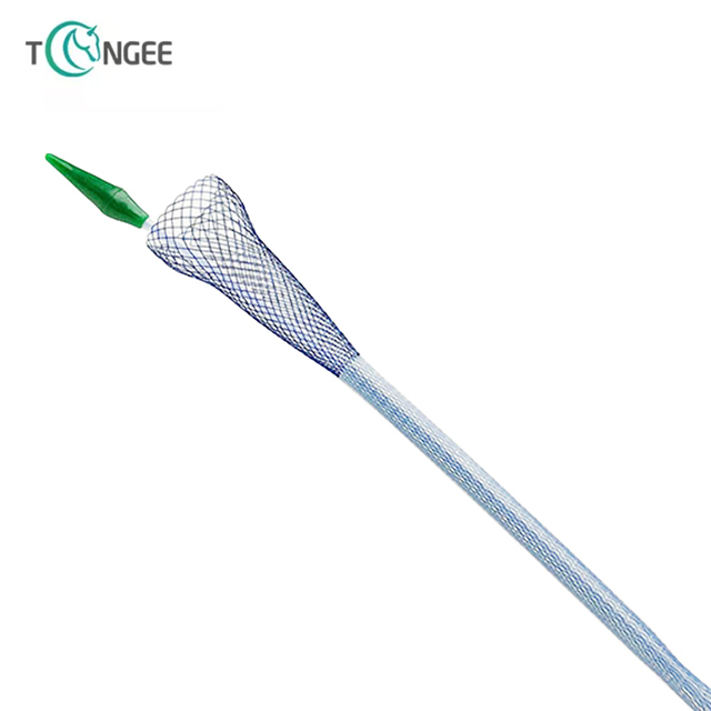 Intestinal Stent - Colon Stent