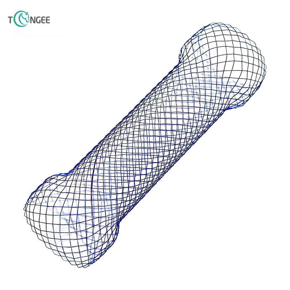 Esophagus stent 5