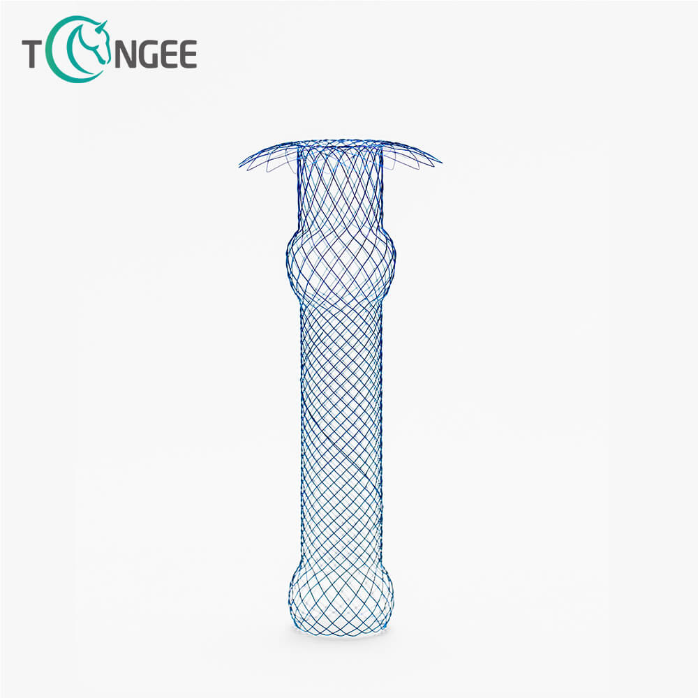 Why do they remove stents from the biliar system?