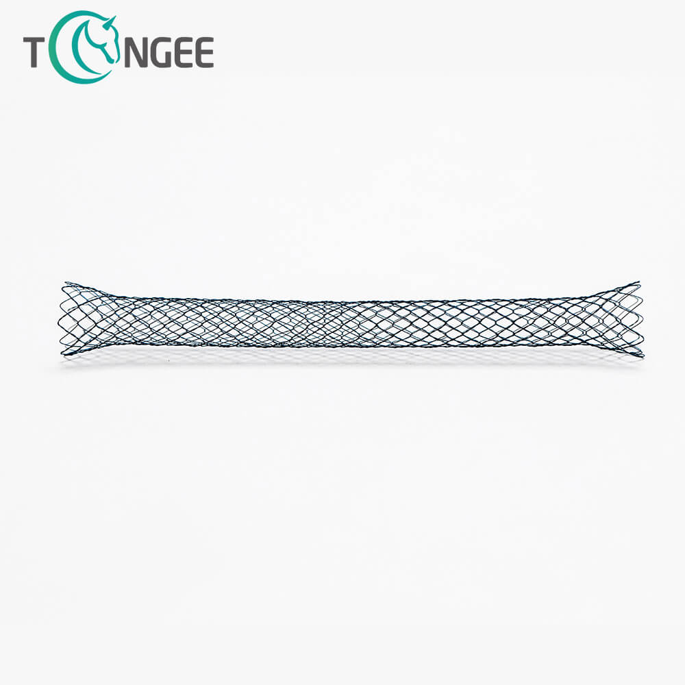 What are the different types of colonic stents?