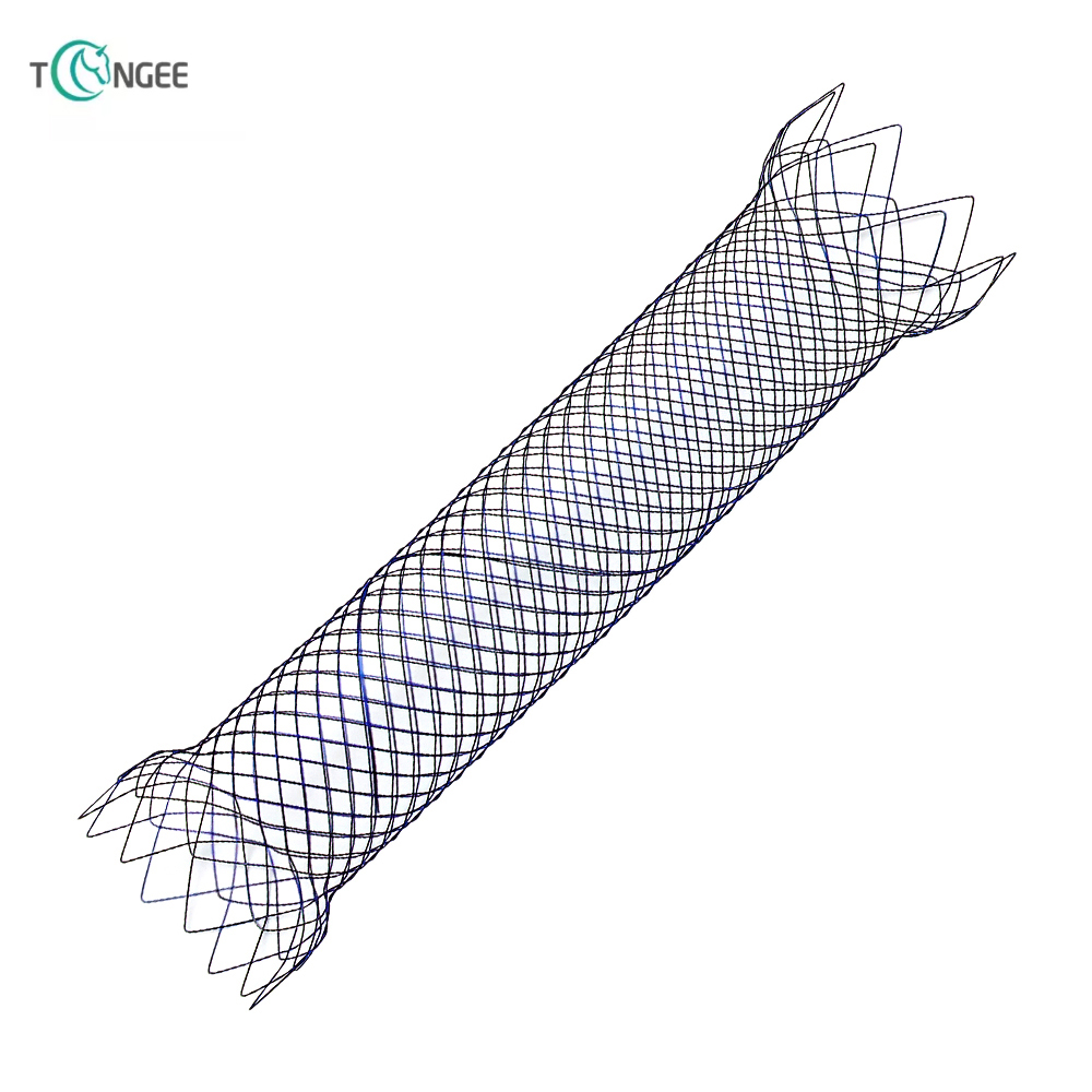 What are the complications of a pyloric stent?