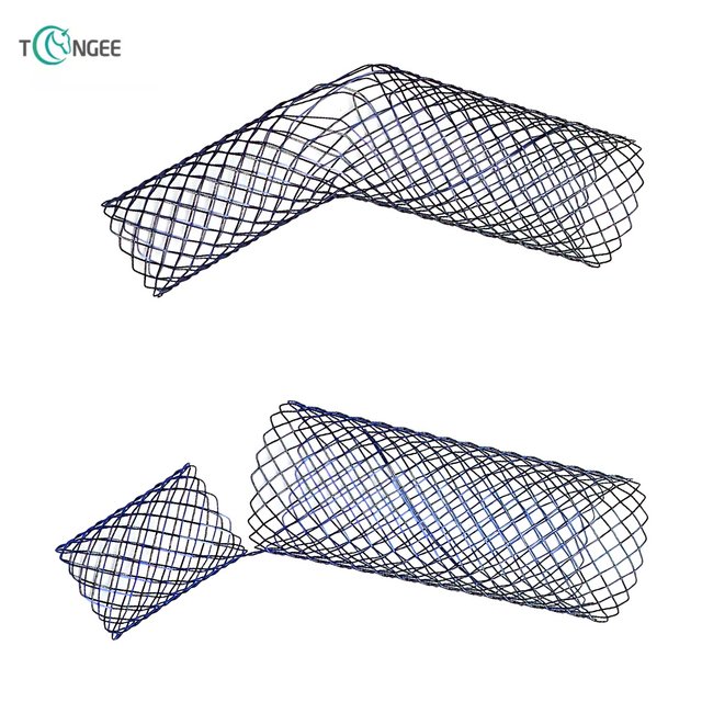 Trachea/Bronchus Stent - J Type Trachea/Bronchus Stent 