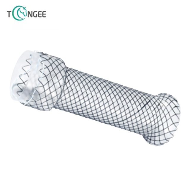 Intestinal Customized stent - Based on customer design