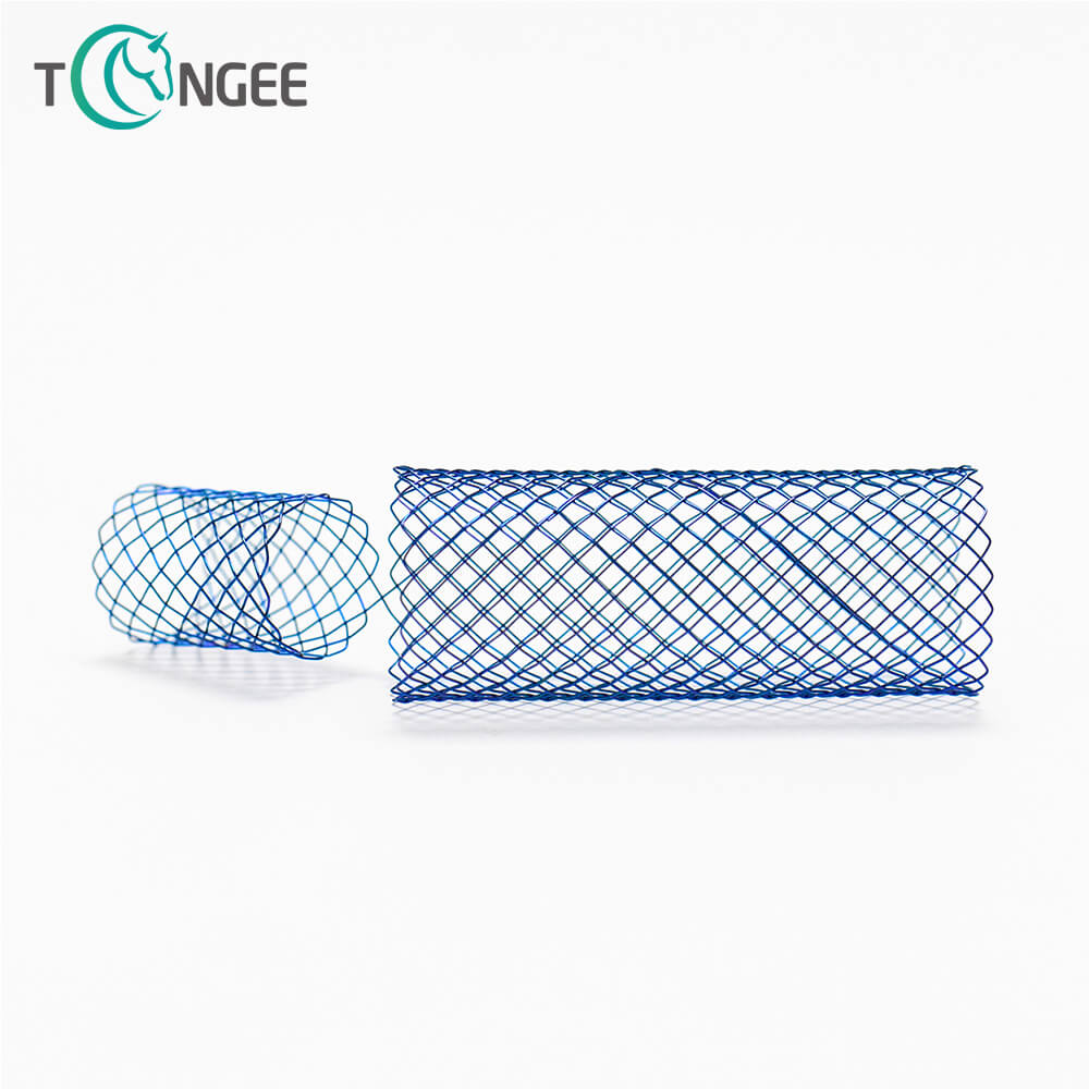 How Long Can An Esophageal Stent Stay In?