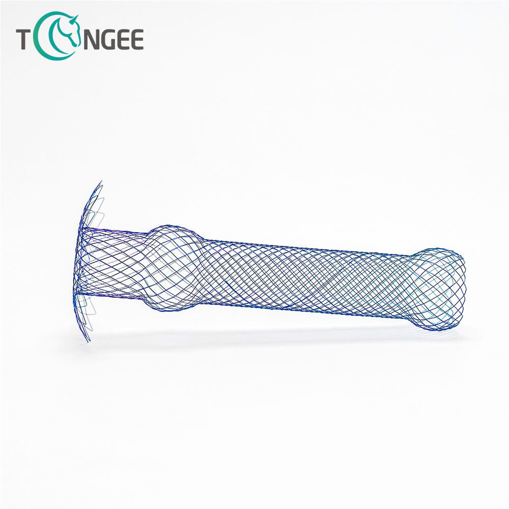 Is A Heart Stent A Serious Surgery?