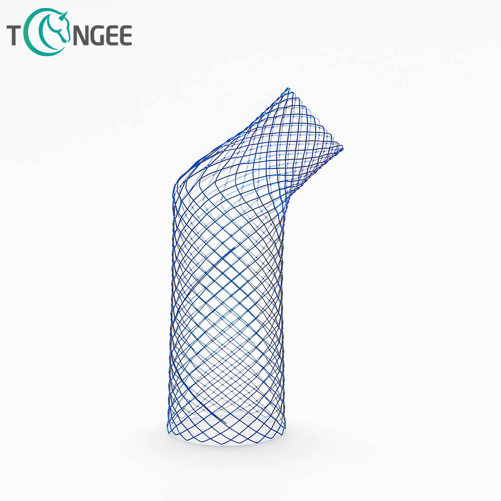 What imaging tests are used to check biliary stent placement?