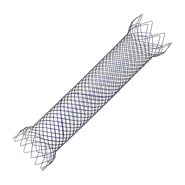 Intestinal stent - Duodenal stent